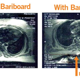BariBoard